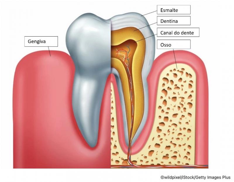 Diabetes não controlado pode aumentar a severidade dos problemas de canal do dente